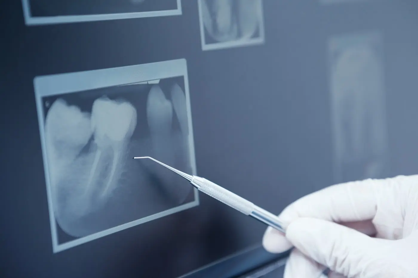Dentist pointing to dental X-ray images, explaining results.