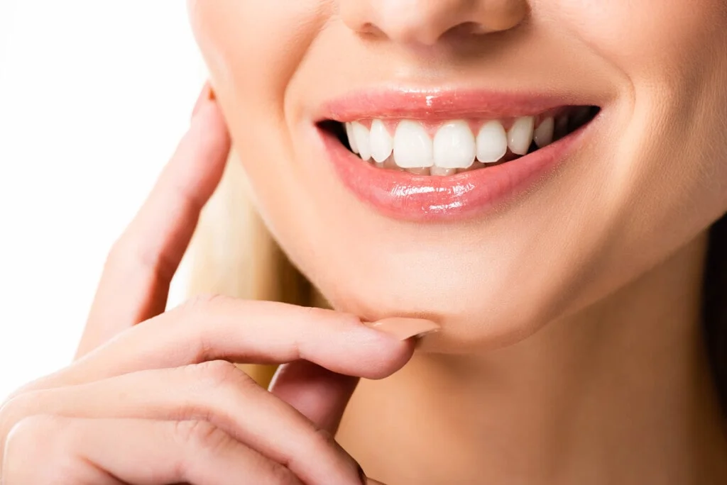 Close-up view of a flawless smile transformed by natural-looking dental veneers.
